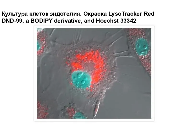Культура клеток эндотелия. Окраска LysoTracker Red DND-99, a BODIPY derivative, and Hoechst 33342