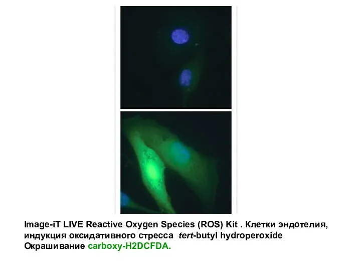 Image-iT LIVE Reactive Oxygen Species (ROS) Kit . Клетки эндотелия, индукция оксидативного