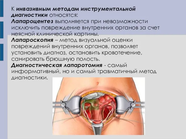 К инвазивным методам инструментальной диагностики относятся: Лапароцентез выполняется при невозможности исключить повреждение