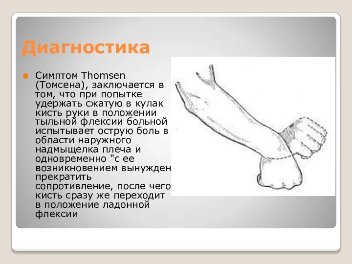 Диагностика Симптом Thomsen (Томсена), заключается в том, что при попытке удержать сжатую