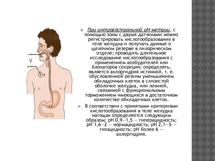 При интрагастральной рН-метрии, с помощью зоны с двумя датчиками можно регистрировать кислотообразование