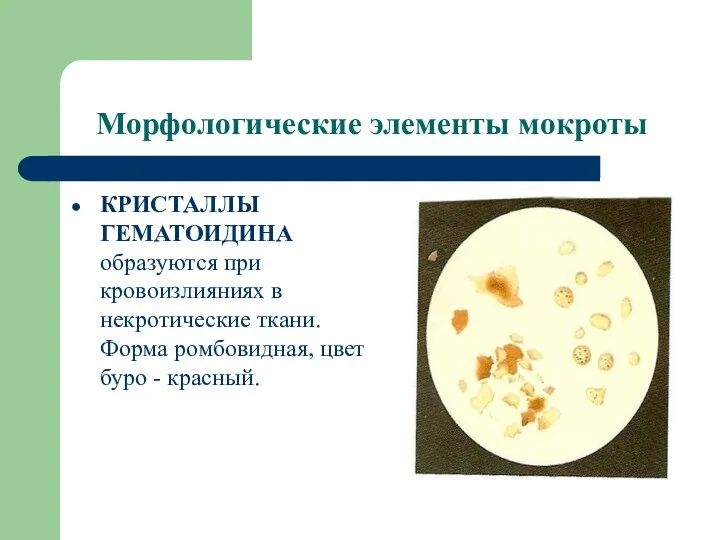 Морфологические элементы мокроты КРИСТАЛЛЫ ГЕМАТОИДИНА образуются при кровоизлияниях в некротические ткани. Форма