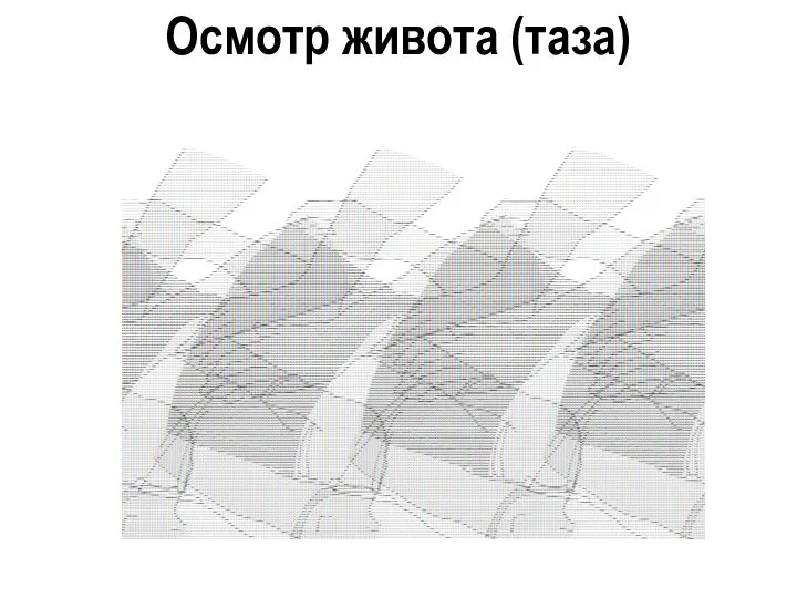 Осмотр живота (таза)