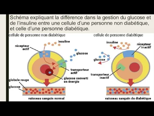 Schéma expliquant la différence dans la gestion du glucose et de l’insuline