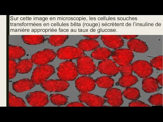 Sur cette image en microscopie, les cellules souches transformées en cellules bêta