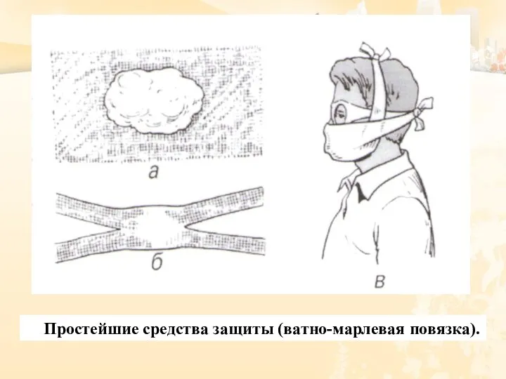 Простейшие средства защиты (ватно-марлевая повязка).