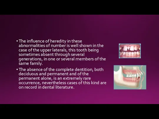 The influence of heredity in these abnormalities of number is well shown