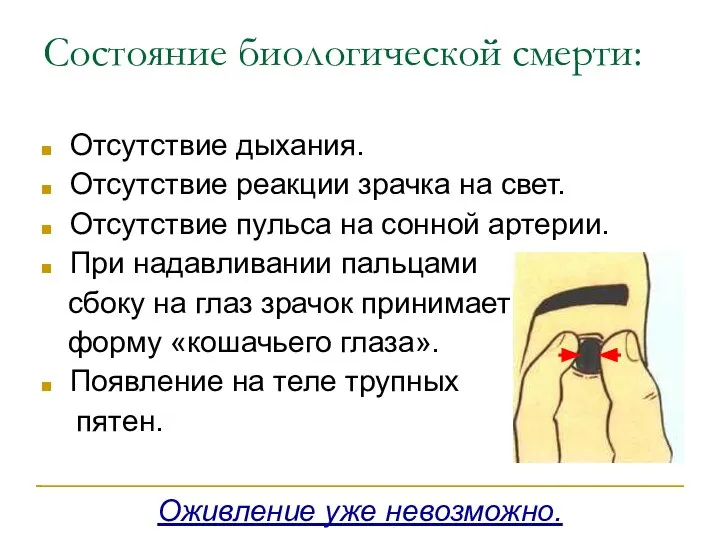 Состояние биологической смерти: Отсутствие дыхания. Отсутствие реакции зрачка на свет. Отсутствие пульса