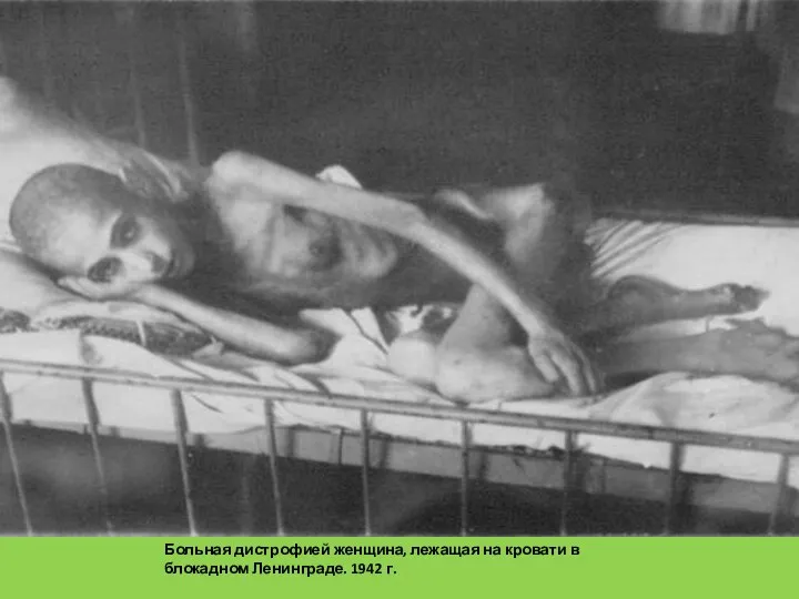 Больная дистрофией женщина, лежащая на кровати в блокадном Ленинграде. 1942 г.