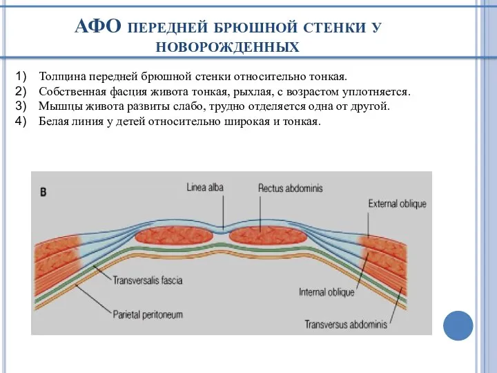 АФО передней брюшной стенки у новорожденных Толщина передней брюшной стенки относительно тонкая.