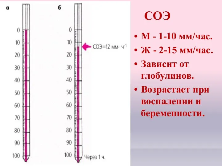 СОЭ М - 1-10 мм/час. Ж - 2-15 мм/час. Зависит от глобулинов.