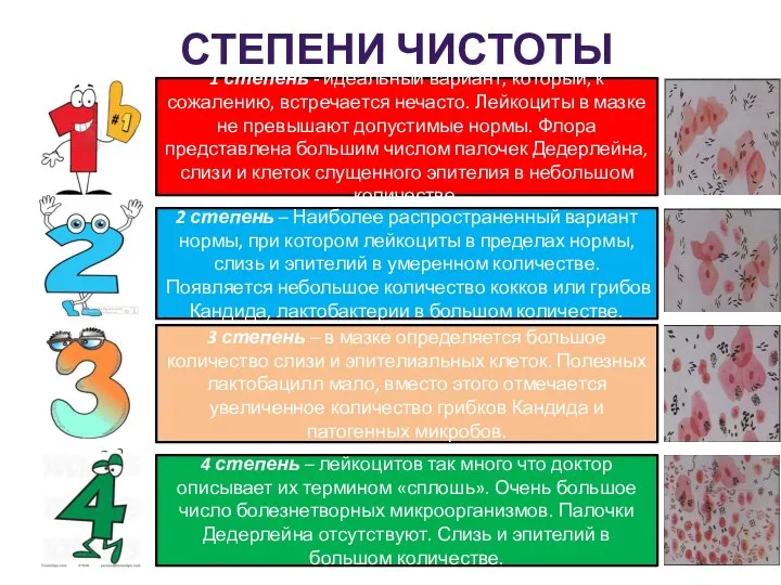 СТЕПЕНИ ЧИСТОТЫ ВЛАГАЛИЩА СТЕПЕНИ ЧИСТОТЫ ВЛАГАЛИЩА 4 степень – лейкоцитов так много