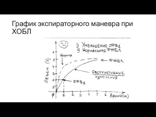 График экспираторного маневра при ХОБЛ