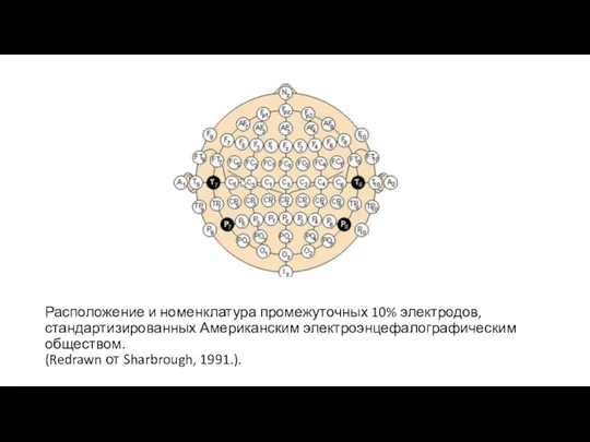 Расположение и номенклатура промежуточных 10% электродов, стандартизированных Американским электроэнцефалографическим обществом. (Redrawn от Sharbrough, 1991.).