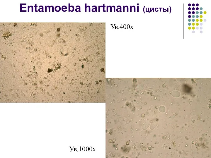 Entamoeba hartmanni (цисты) Ув.400х Ув.1000х