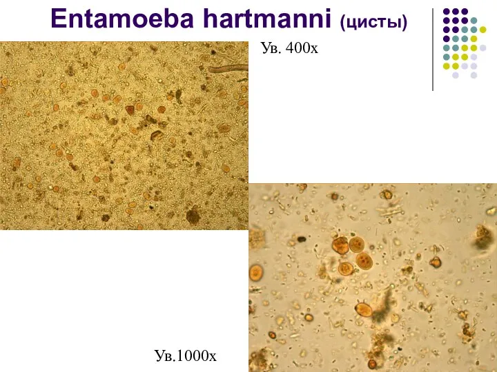 Entamoeba hartmanni (цисты) Ув. 400х Ув.1000х