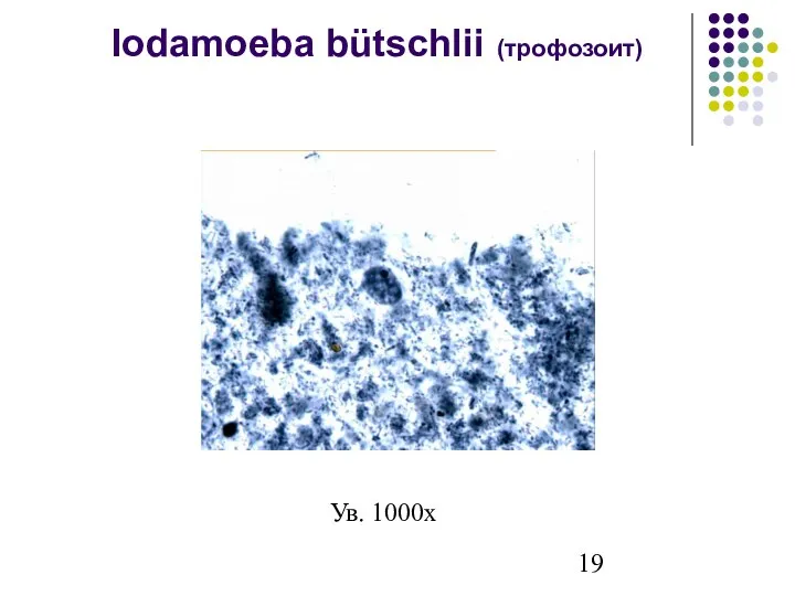 Iodamoeba bütschlii (трофозоит) Ув. 1000х