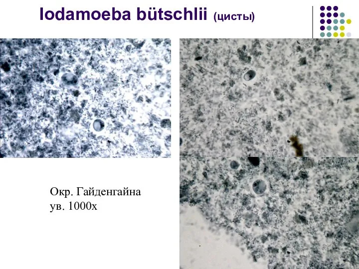 Iodamoeba bütschlii (цисты) Окр. Гайденгайна ув. 1000х