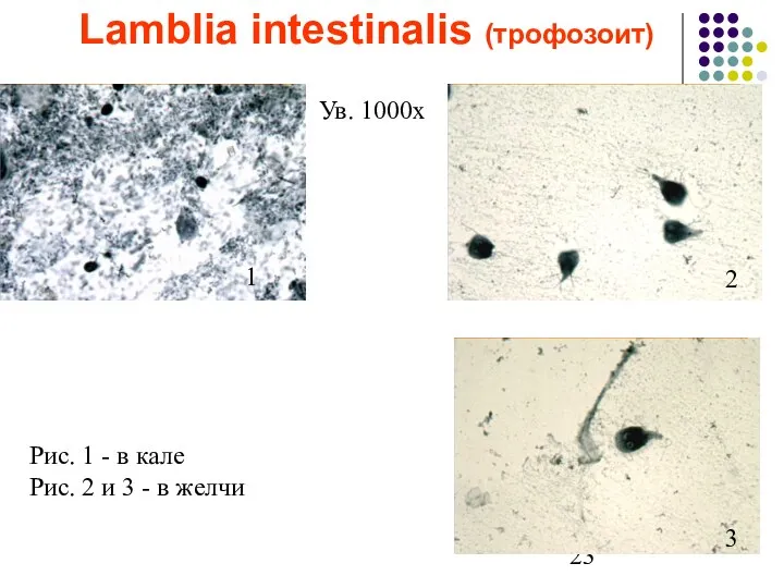 Lamblia intestinalis (трофозоит) Ув. 1000х 1 2 3 Рис. 1 - в