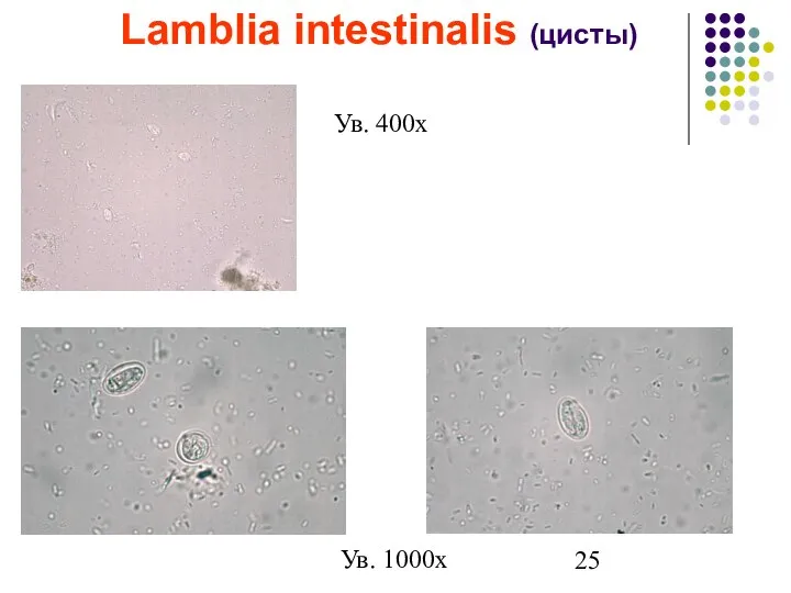 Lamblia intestinalis (цисты) Ув. 400х Ув. 1000х