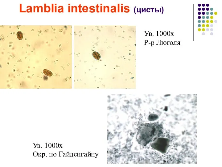 Lamblia intestinalis (цисты) Ув. 1000х Р-р Люголя Ув. 1000х Окр. по Гайденгайну