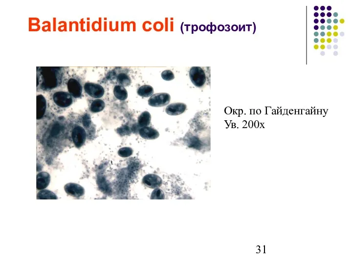 Balantidium coli (трофозоит) Окр. по Гайденгайну Ув. 200х