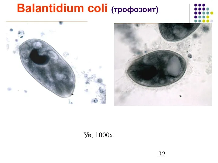 Balantidium coli (трофозоит) Ув. 1000х