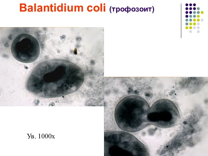 Balantidium coli (трофозоит) Ув. 1000х