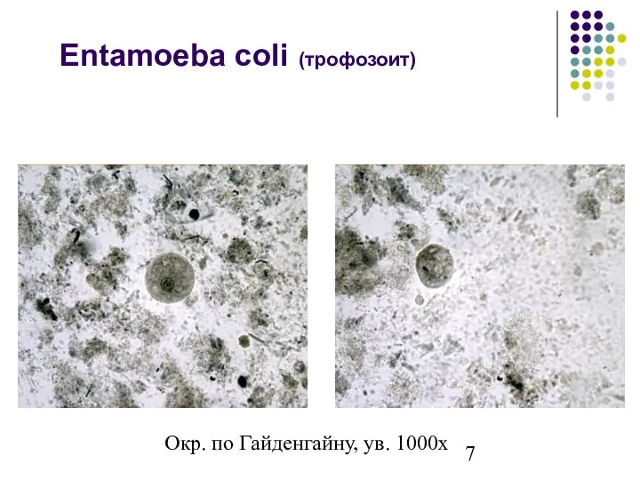 Entamoeba coli (трофозоит) Окр. по Гайденгайну, ув. 1000х