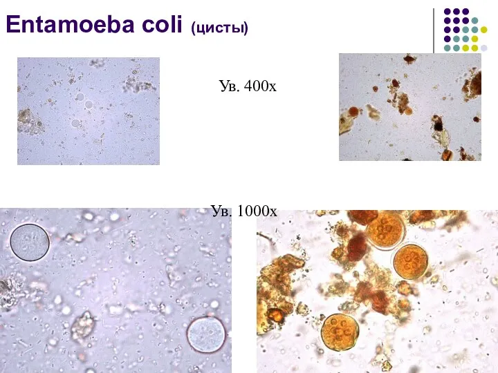 Entamoeba coli (цисты) Ув. 400х Ув. 1000х