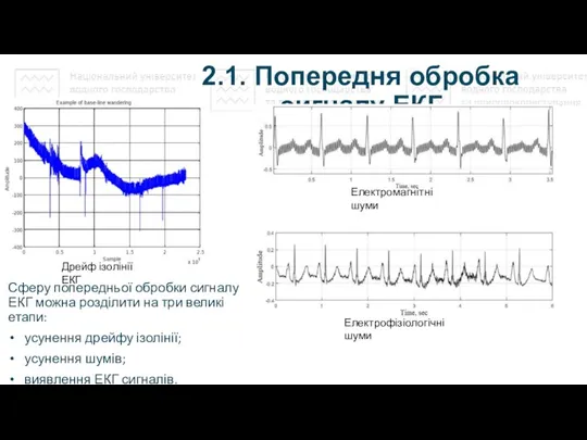 2.1. Попередня обробка сигналу ЕКГ Сферу попередньої обробки сигналу ЕКГ можна розділити