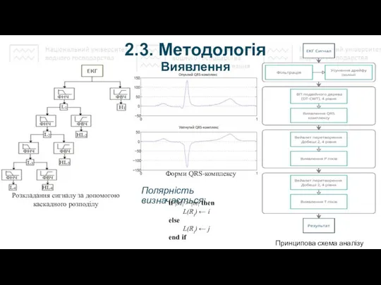 2.3. Методологія Принципова схема аналізу ЕКГ Полярність визначається: Виявлення Розкладання сигналу за