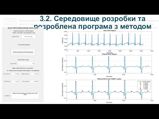 3.2. Середовище розробки та розроблена програма з методом