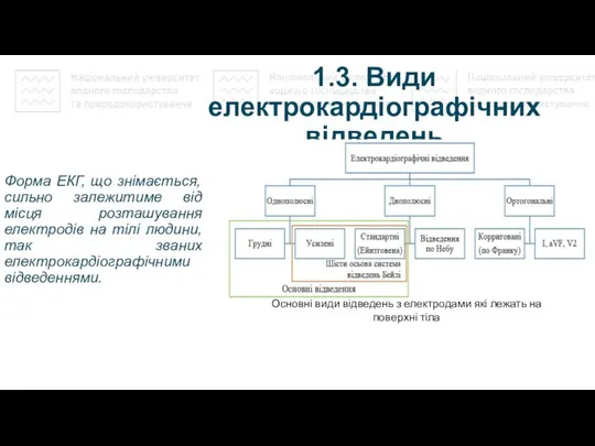 1.3. Види електрокардіографічних відведень Форма ЕКГ, що знімається, сильно залежитиме від місця