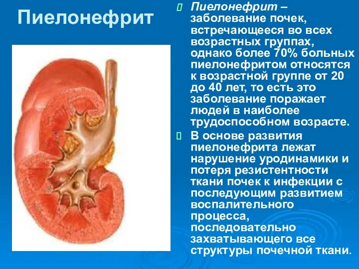 Пиелонефрит Пиелонефрит – заболевание почек, встречающееся во всех возрастных группах, однако более