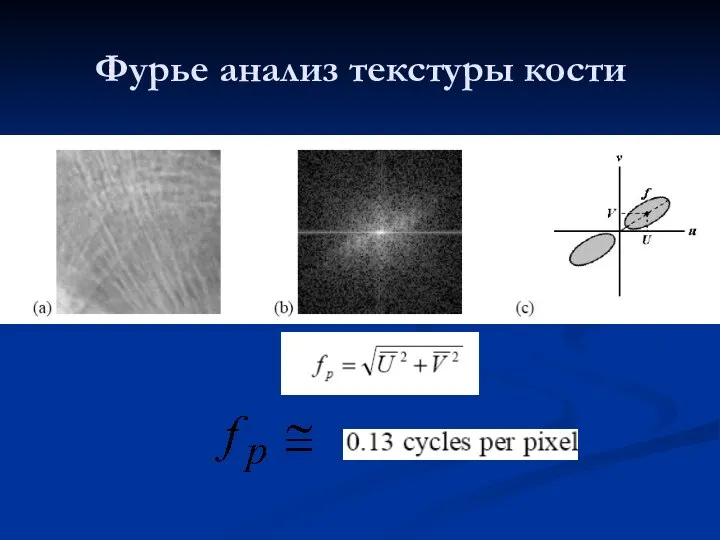 Фурье анализ текстуры кости