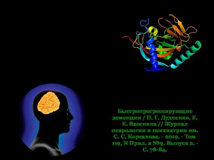 Быстропрогрессирующие деменции / Н. Г. Дудченко, Е. Е. Васенина // Журнал неврологии