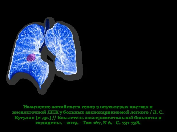 Изменение копийности генов в опухолевых клетках и внеклеточной ДНК у больных аденокарциномой