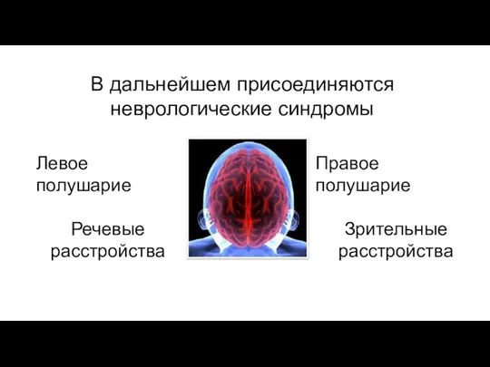 Левое полушарие Речевые расстройства Правое полушарие Зрительные расстройства В дальнейшем присоединяются неврологические синдромы