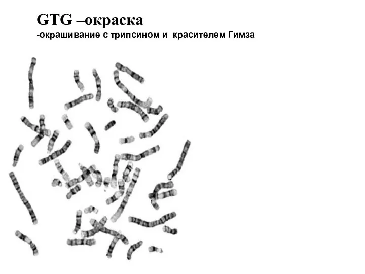 GTG –окраска -окрашивание с трипсином и красителем Гимза