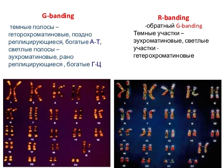 G-banding темные полосы –геторохроматиновые, поздно реплицирующиеся, богатые А-Т, светлые полосы – эухроматиновые,