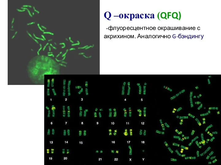 Q –окраска (QFQ) -флуоресцентное окрашивание с акрихином. Аналогично G-бэндингу