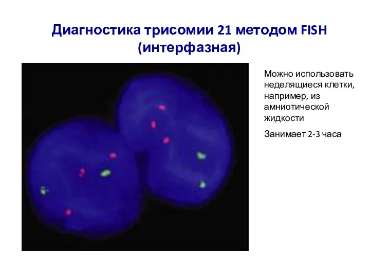 Диагностика трисомии 21 методом FISH (интерфазная) Можно использовать неделящиеся клетки, например, из
