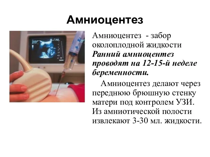 Амниоцентез Амниоцентез - забор околоплодной жидкости Ранний амниоцентез проводят на 12-15-й неделе