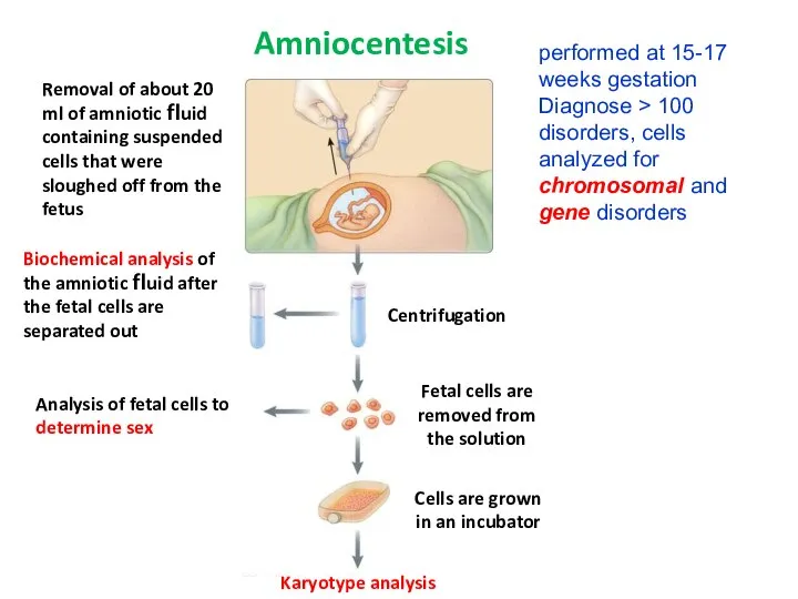 Removal of about 20 ml of amniotic ﬂuid containing suspended cells that