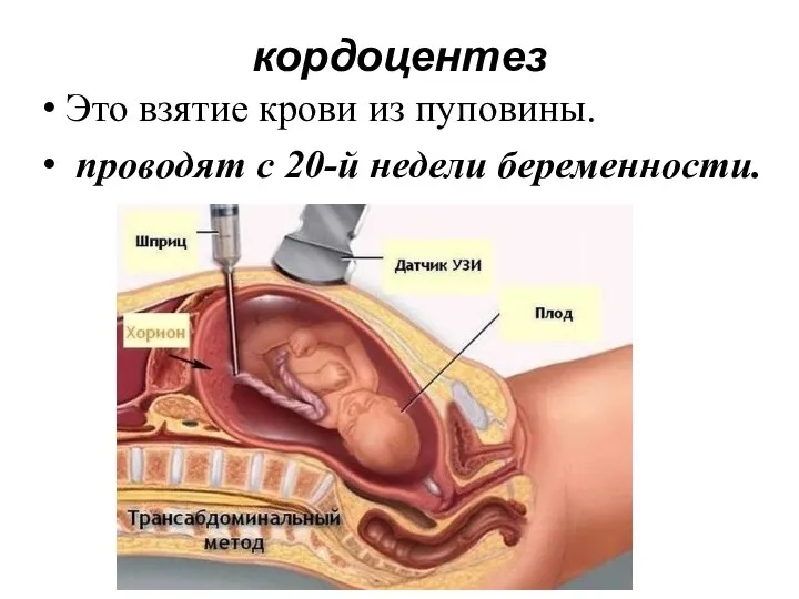 кордоцентез Это взятие крови из пуповины. проводят с 20-й недели беременности.