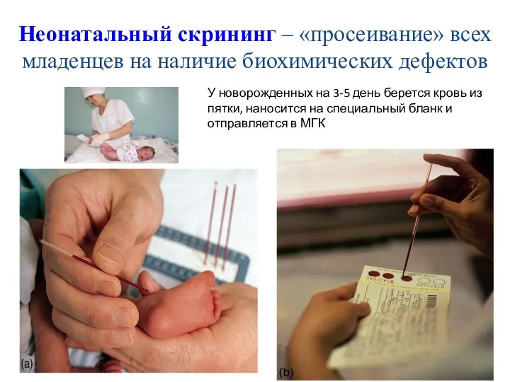 Неонатальный скрининг – «просеивание» всех младенцев на наличие биохимических дефектов У новорожденных