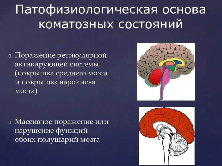 Патофизиологическая основа коматозных состояний Поражение ретикулярной активирующей системы (покрышка среднего мозга и