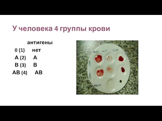 У человека 4 группы крови антигены 0 (1) нет А (2) А