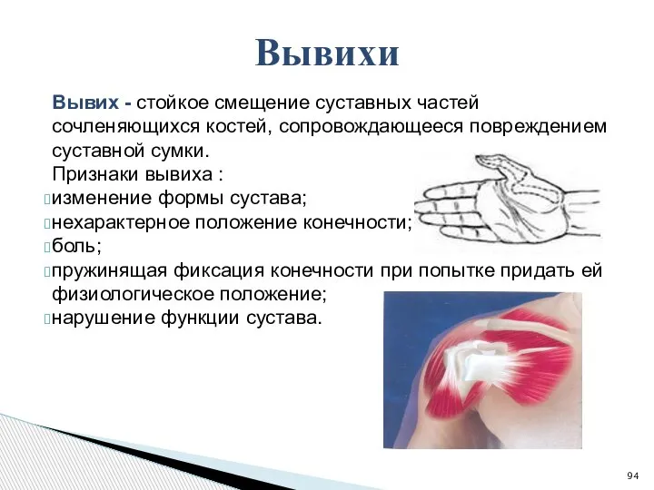 Вывих - стойкое смещение суставных частей сочленяющихся костей, сопровождающееся повреждением суставной сумки.